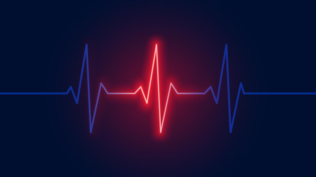 Bradicardia-puls-sub-60-batai-puls-inima