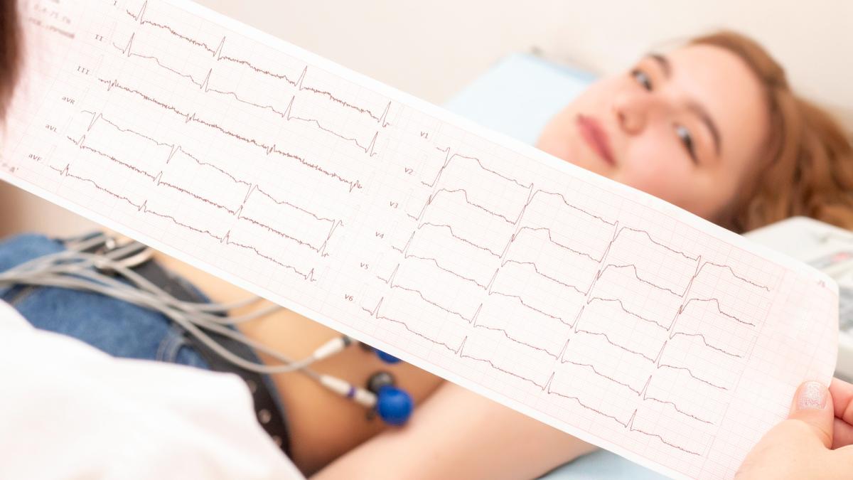 Infarctul, impact dramatic. Dr. Monica Trofin-Bănescu Eveniment major cu conotație negativă