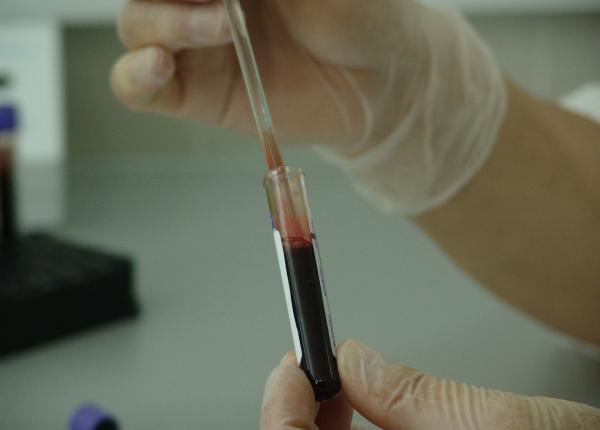 cifre alarmante la fiecare trei minute o adolescenta se contamineaza cu hiv cifre alarmante la fiecare trei minute o adolescenta se contamineaza cu hiv