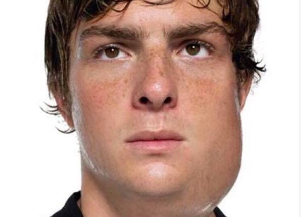 oreion simptome i vaccinuri eficiente