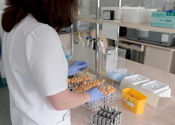 febuxostat protejeaza rinichii in hiperuricemie risc cardiovascular neclar