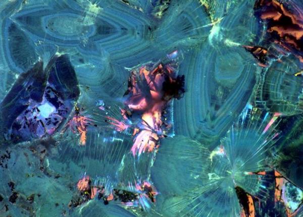 calculi renali o lume fascinanta in interior