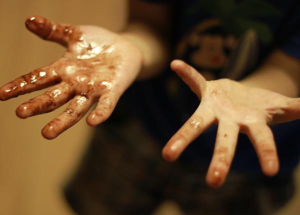 mure focare de hepatita a 80 de cazuri confirmate