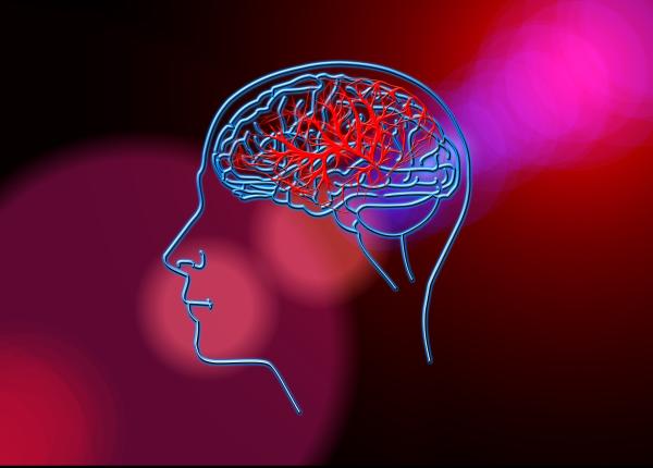 accidentul vascular cerebral ase lucruri pe care trebuie sa le tii