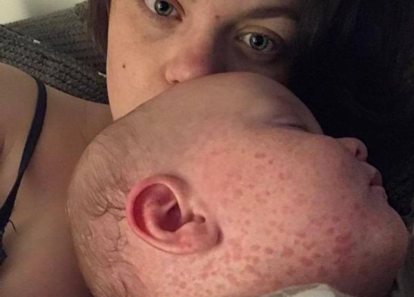 mama mesaj disperat copilul meu de 9 luni a facut rujeola vaccina i va copiii
