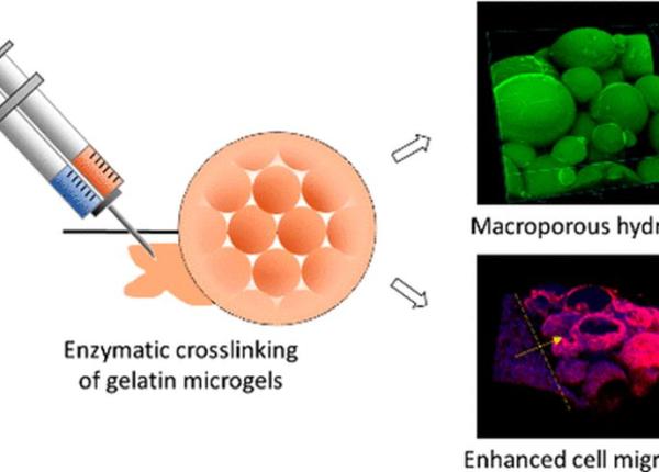 rani vindecare rapida cu un hidrogel injectabil