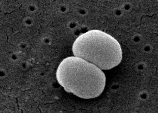bacteria poten ial mortala care e pe pielea tuturor