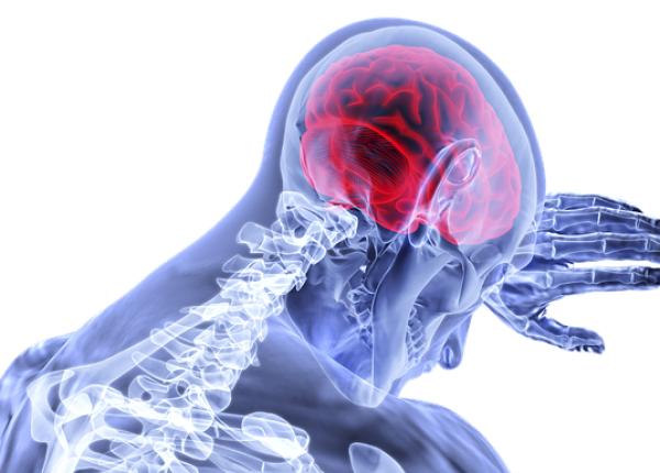 microsangerari cerebrale detectate prin inva area profunda 3d microsangerari cerebrale detectate prin inva area profunda 3d