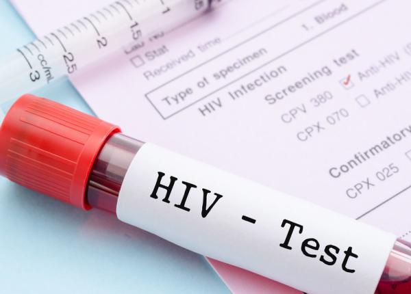 dr monica dan despre infec ia cu hiv in romania numarul de cazuri noi a scazut dr monica dan despre infec ia cu hiv in romania numarul de cazuri noi a scazut