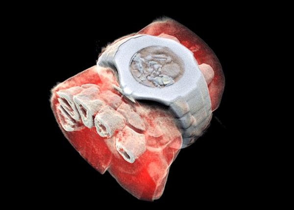 prima radiografie 3d color realizata cu tehnologie cern