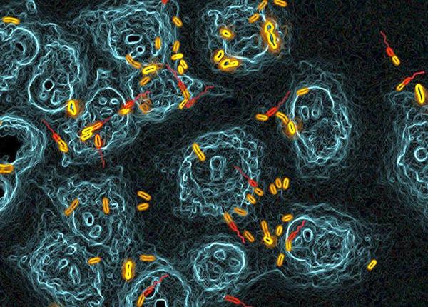 infec ii nosocomiale bacteriile periculoase se comporta ca in afaceri