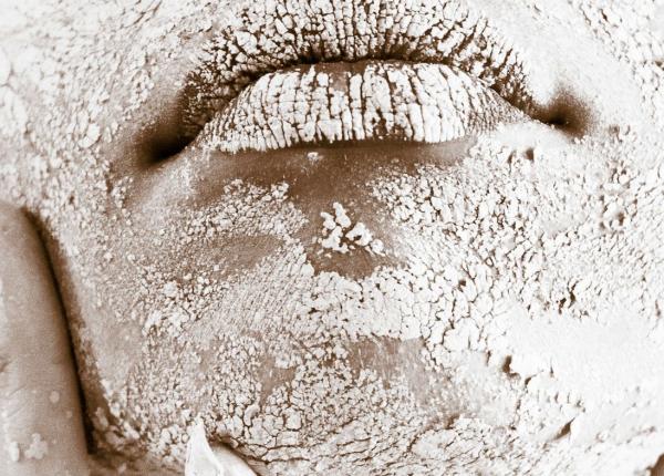 prof dr calin giurcaneanu pielea i zecile de mecanisme prin care ea apara organismul prof dr calin giurcaneanu pielea i zecile de mecanisme prin care ea apara organismul