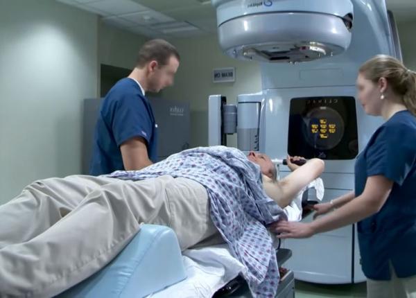 fibroza cutanata asociata radioterapiei la pacien ii cu cancer redusa