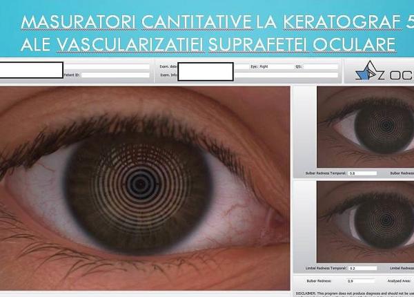 peste 10 000 de pacien i cu afec iuni la ochi trata i in 2018 la suub