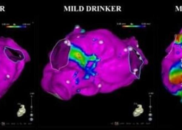 doua pahare de vin pe zi scanare inima imagini ocante