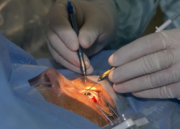 numarul transplanturilor de cornee in scadere cate opera ii s au facut in 2018 la spitalul militar dr carol davila