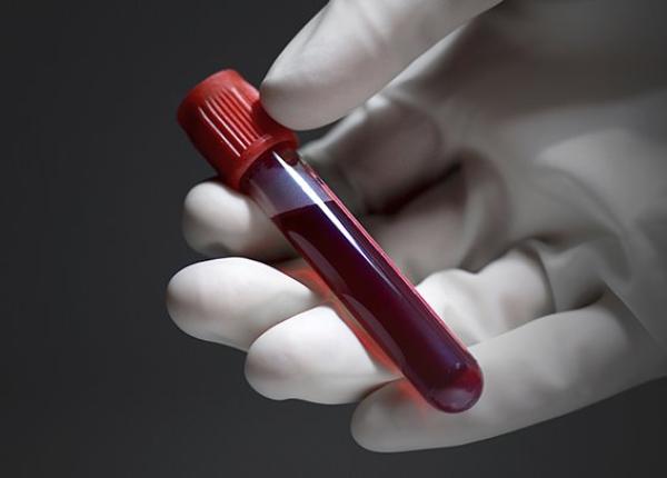 tbc noi teste de sange mai precise in identificarea tuberculozei