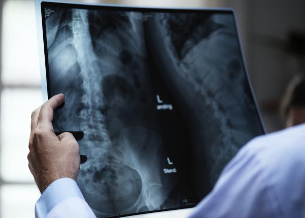 radiografii toracice triate automat cu ajutorul inteligen ei artificiale radiografii toracice triate automat cu ajutorul inteligen ei artificiale