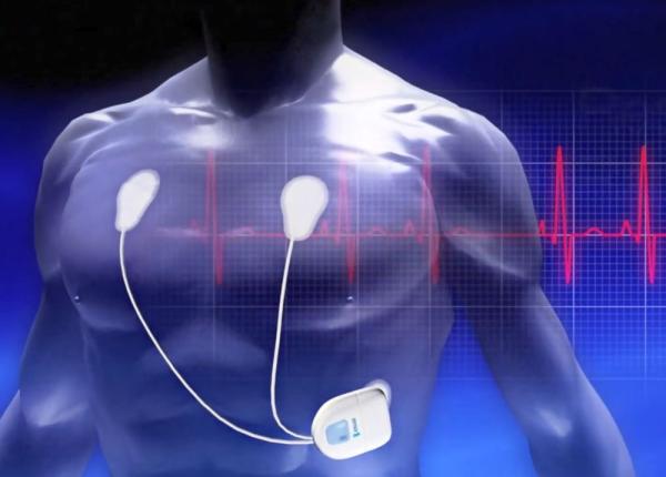 hipertensiune i monitor holter de ce e bine sa tii ce tensiune ai noaptea