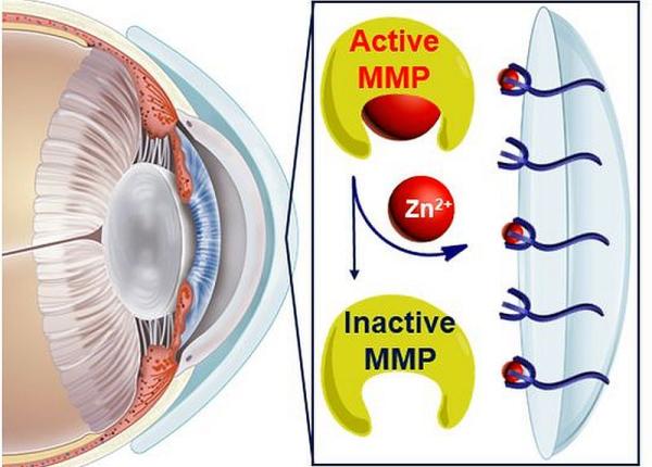 topirea corneei tratata cu un hidrogel lentila de contact