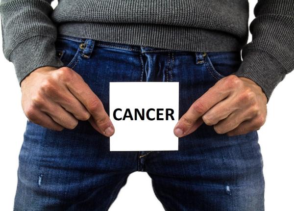 cancerul testicular i dieta vezi ce aliment este principalul vinovat