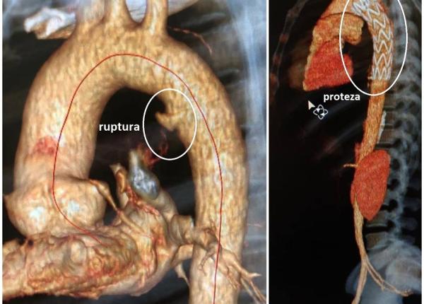 interven ie medicala dificila realizata cu succes de medici