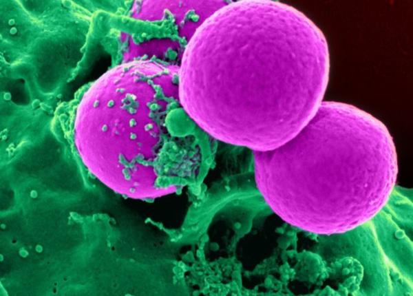 microglia studiu recent de la universitatea notre dame