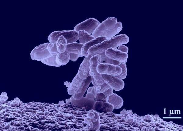 tuberculoza cauze genetice descoperirea cercetatorilor