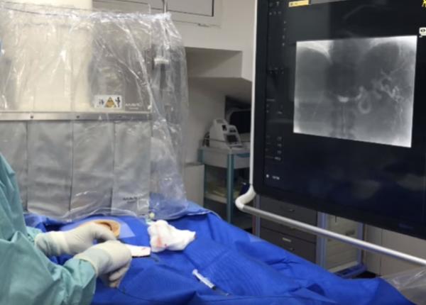 radiologul interven ionist bogdan popa navigam in interiorul vaselor exclusiv