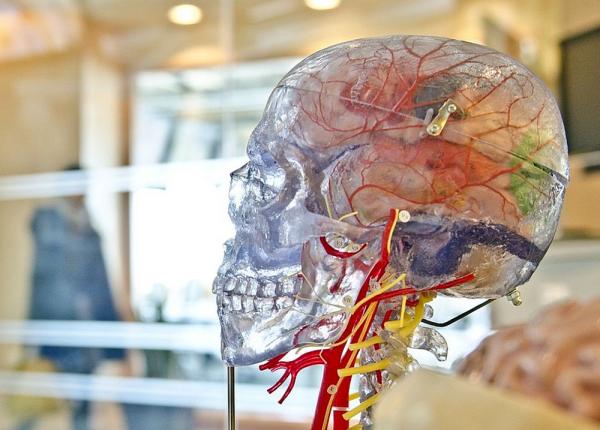 anevrisme detectate cu ajutorul inteligen ei artificiale