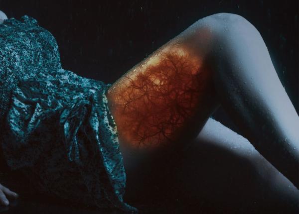 varicele de ce apar i care este riscul de a face cheaguri de sange care sa ajunga la inima