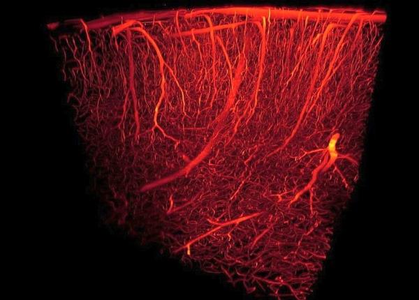 alzheimer descoperire celule care taie aprovizionarea creierului vinovate de declinul cognitiv