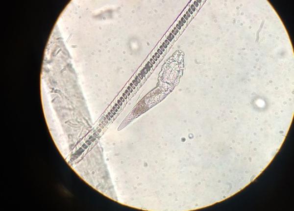 topul celor mai comuni paraziti din corpul uman