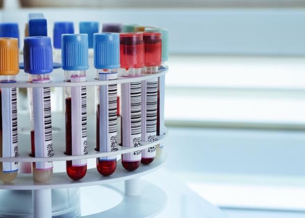 efectele anemiei asupra sistemului cardiovascular efectele anemiei asupra sistemului cardiovascular