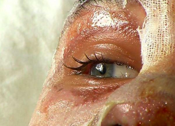 supravie uitorii tragediei din colectiv a a cum boala noastra este pe toata via a avem nevoie ca i tratamentul sa fie la fel