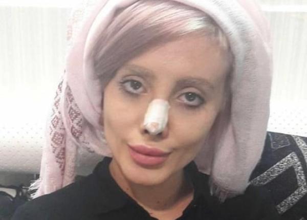 ara unde opera iile estetice te baga n pu carie