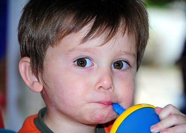 unul din trei copii sub 5 ani la nivel mondial este subnutrit sau supraponderal