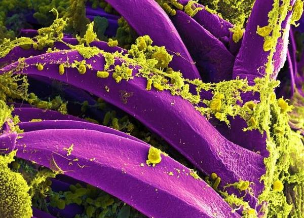 ciuma doi oameni bolnavi cum va proteja i de una dintre cele mai mortale boli din istoria omenirii