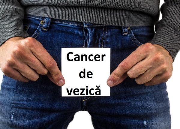 cancerul de vezica urinara medic ace ti pacien i nu trebuie uita i