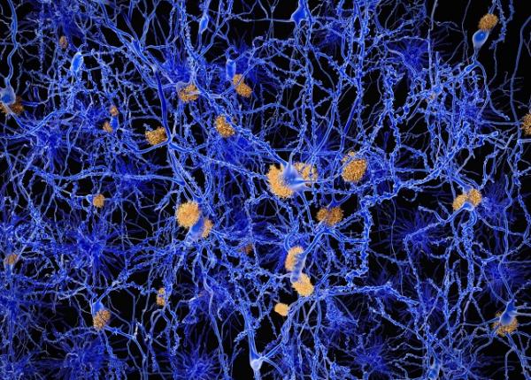 alzheimer poluarea poate contribui la declinul cognitiv