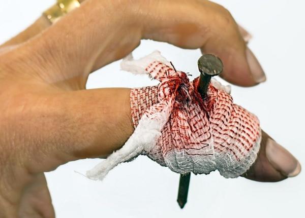 prim ajutor mituri care i fac rau ce faci cand te arzi inghe i sau te rane ti