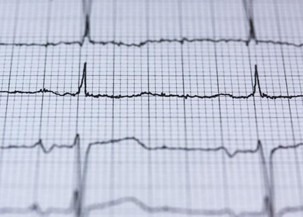insuficienta cardiaca risc mai mare la tinerii care s au nascut cu malforma ii cardiace