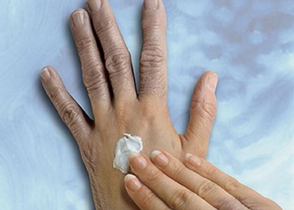 crema de maini care a lasat o femeie infirma con inea mercur organic