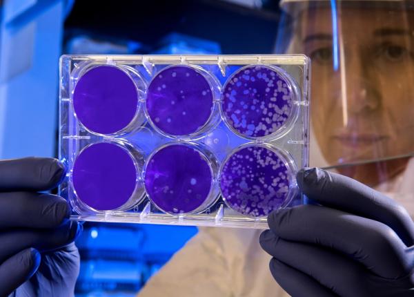 expunerea bacteriana ar putea avea o legatura cu boala celiaca