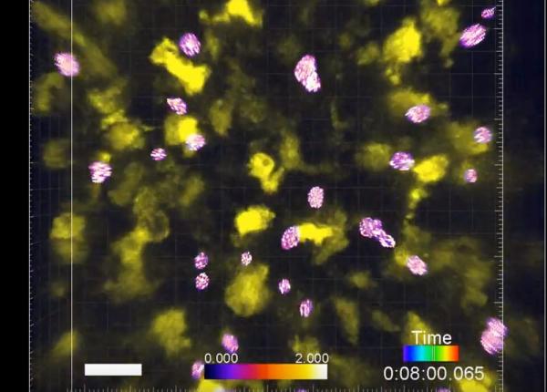 imunitate la cancer descoperirea unor celule imune arata ca e posibil