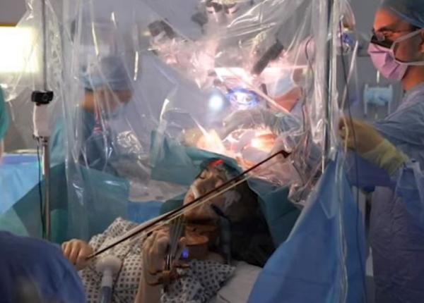 pacienta operata pe creier in timp ce canta la vioara video