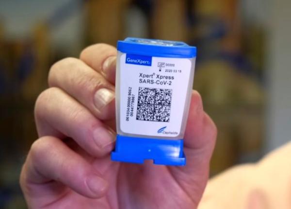 test care arata infectarea cu coronavirus in circa 45 de minute aprobat de americani