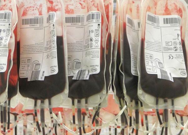 copac apel criza de donatori de sange gasi i o rezolvare impactul va fi devastator copac apel criza de donatori de sange gasi i o rezolvare impactul va fi devastator