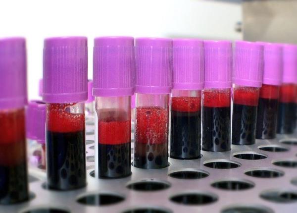 coronavirus origine controversata avertizarea privind problemele de securitate la laboratorul din wuhan