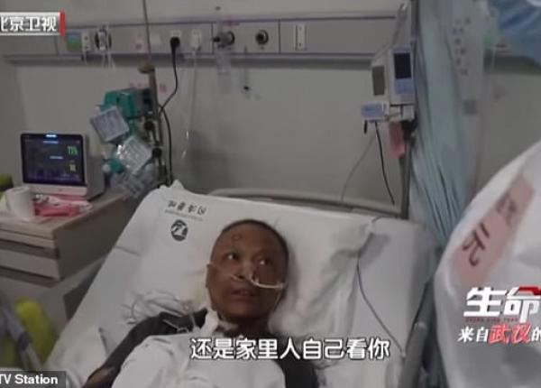 covid 19 doi pacien i infecta i s au trezit cu pielea inchisa la culoare